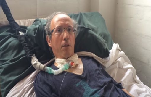 La Esclerosis Lateral Amiotrófica, también conocida como ELA