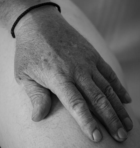 Úlceras por presión, úlceras de decúbito, y escaras todo lo que debes saber